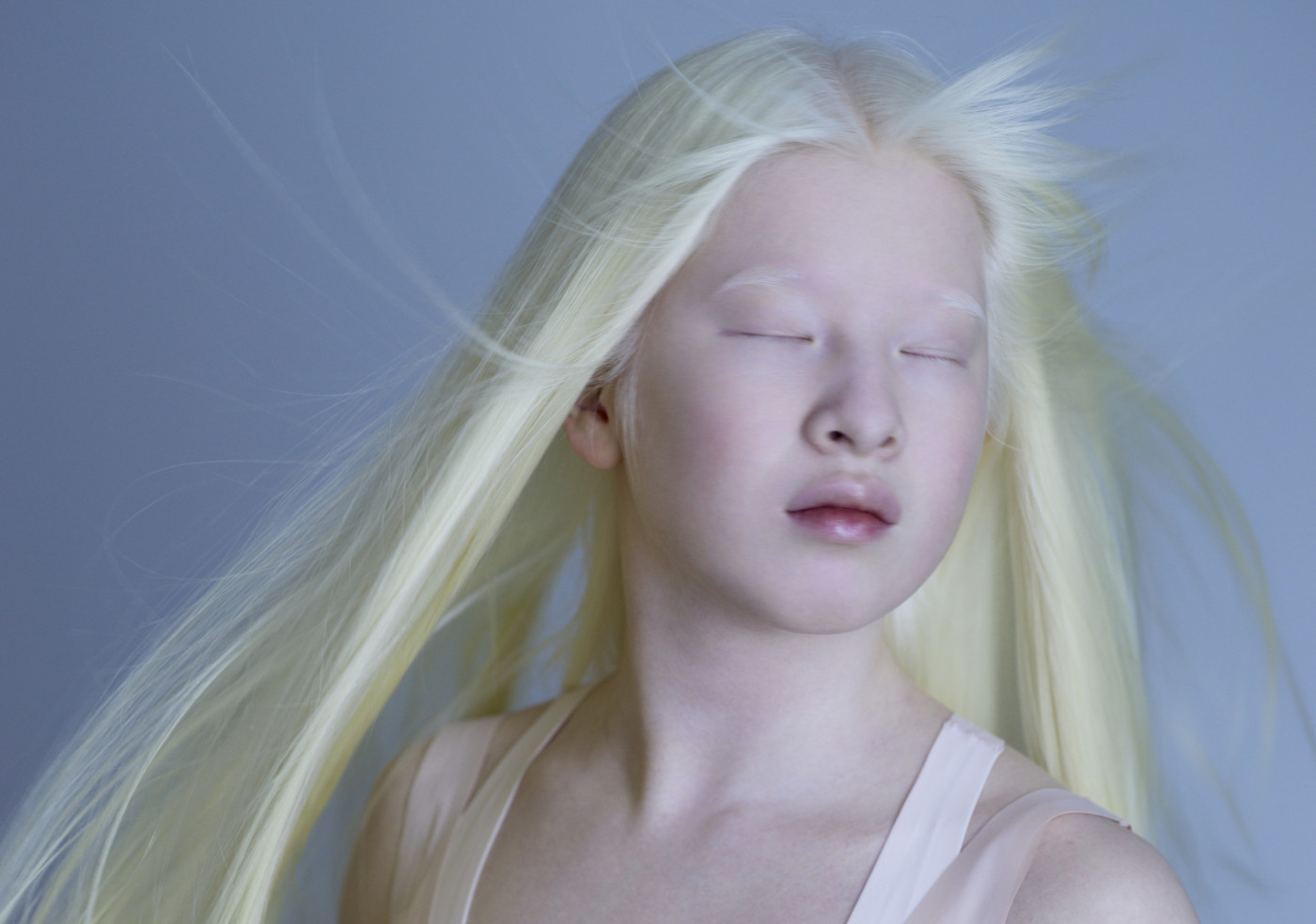 Albino japanese person